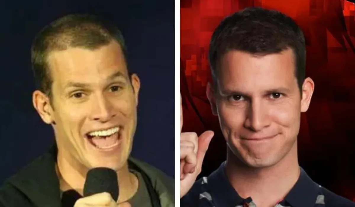 Daniel Tosh Hair Transplant