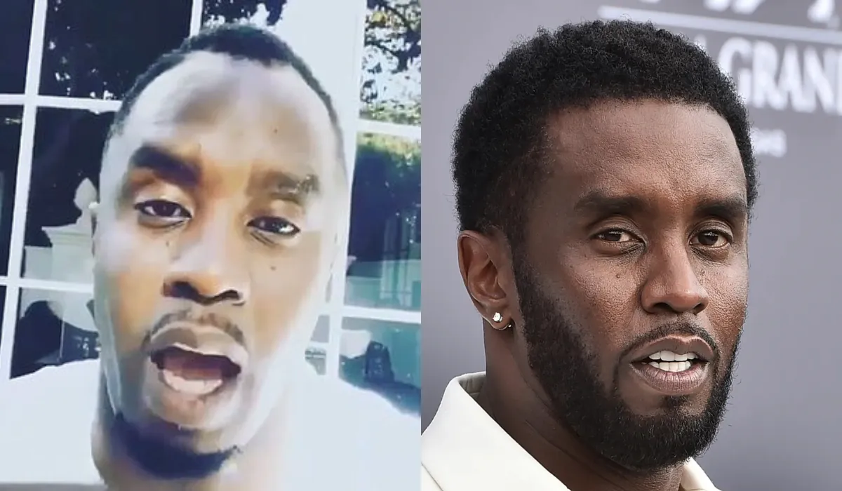 Diddy Hair Transplant