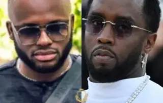 Diddy Hair Transplant