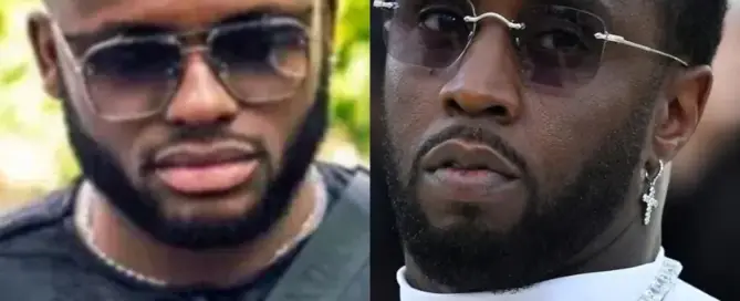 Diddy Hair Transplant