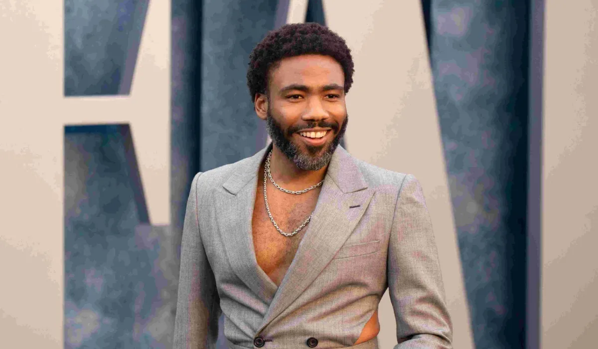 Donald Glover Hair Transplant