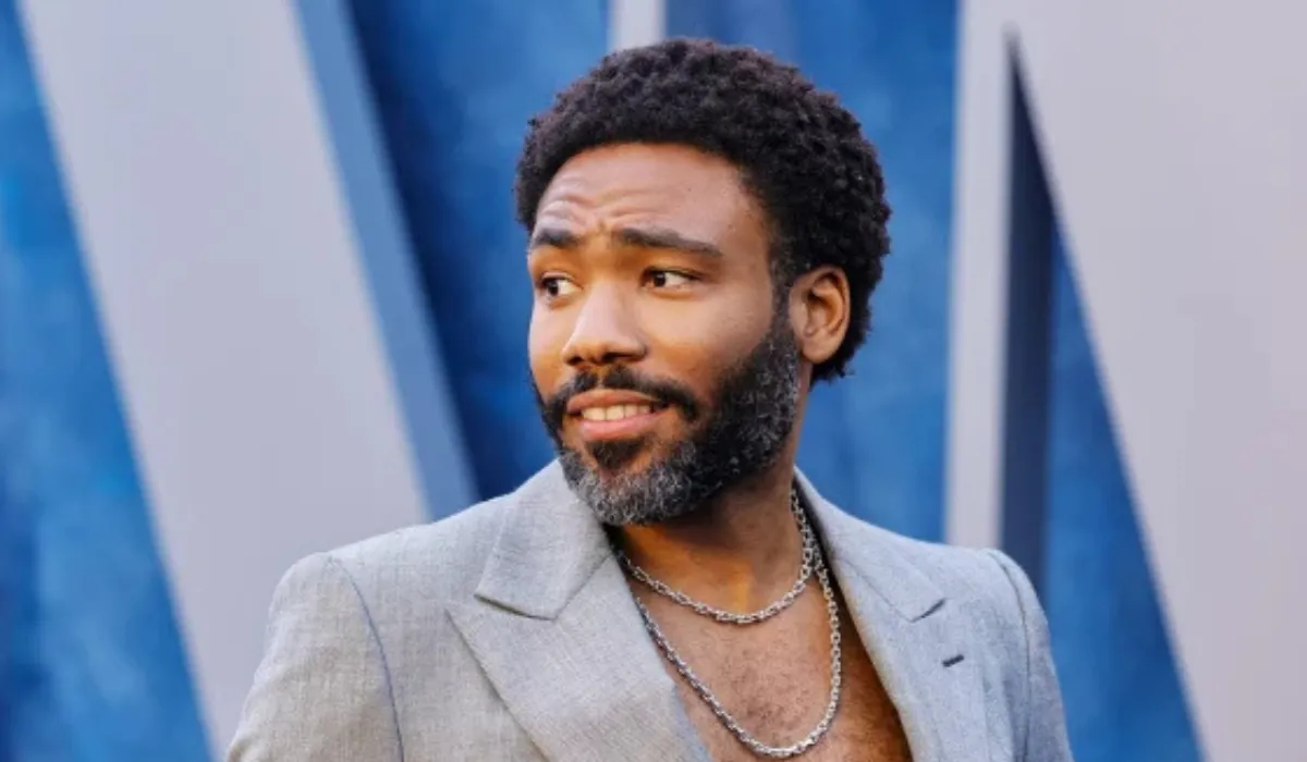 Donald Glover Hair Transplant