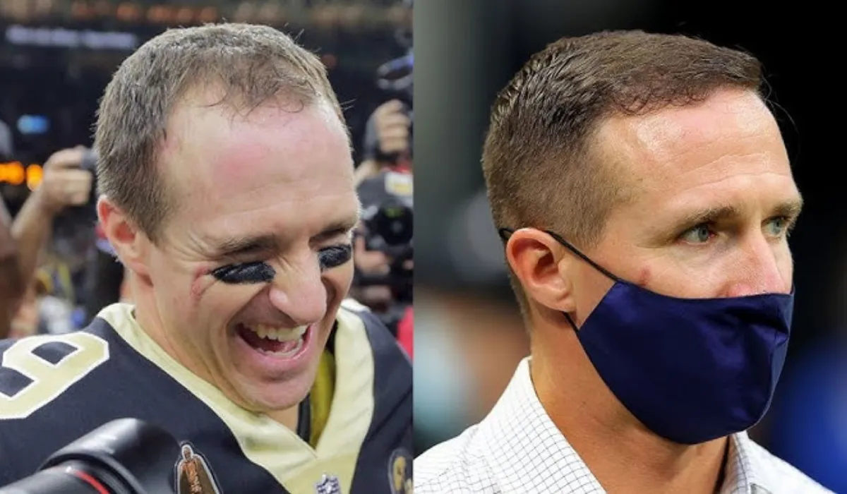 Drew Brees Hair Transplant