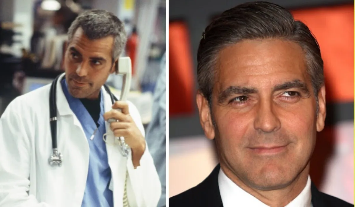 George Clooney Hair Transplant