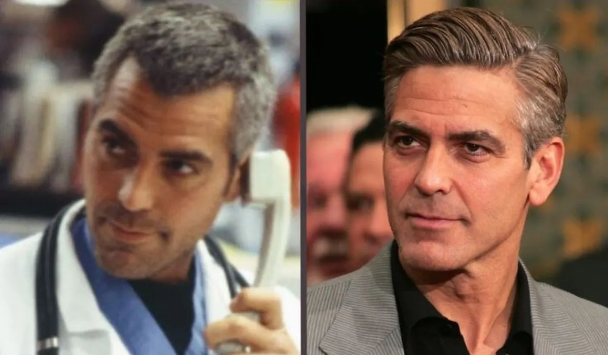 George Clooney Hair Transplant