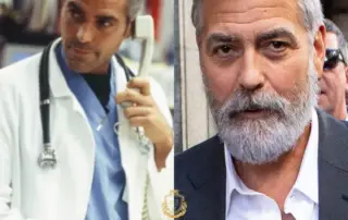 George Clooney Hair Transplant