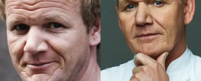 Gordon Ramsay Hair Transplant Before and After