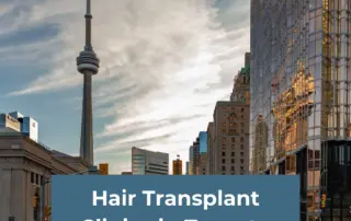 Hair Transplant Clinics in Toronto