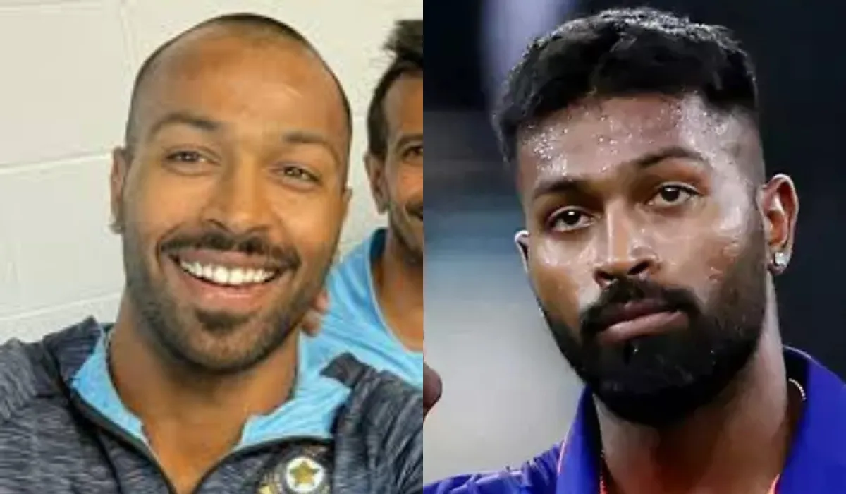 Hardik Pandya Hair Transplant