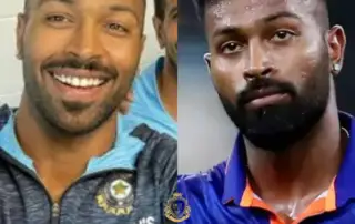 Hardik Pandya Hair Transplant