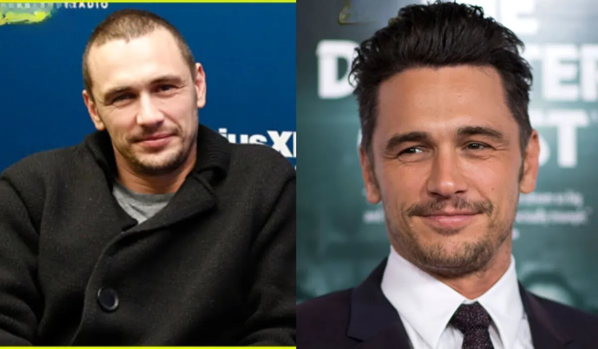 James Franco Hair Transplant