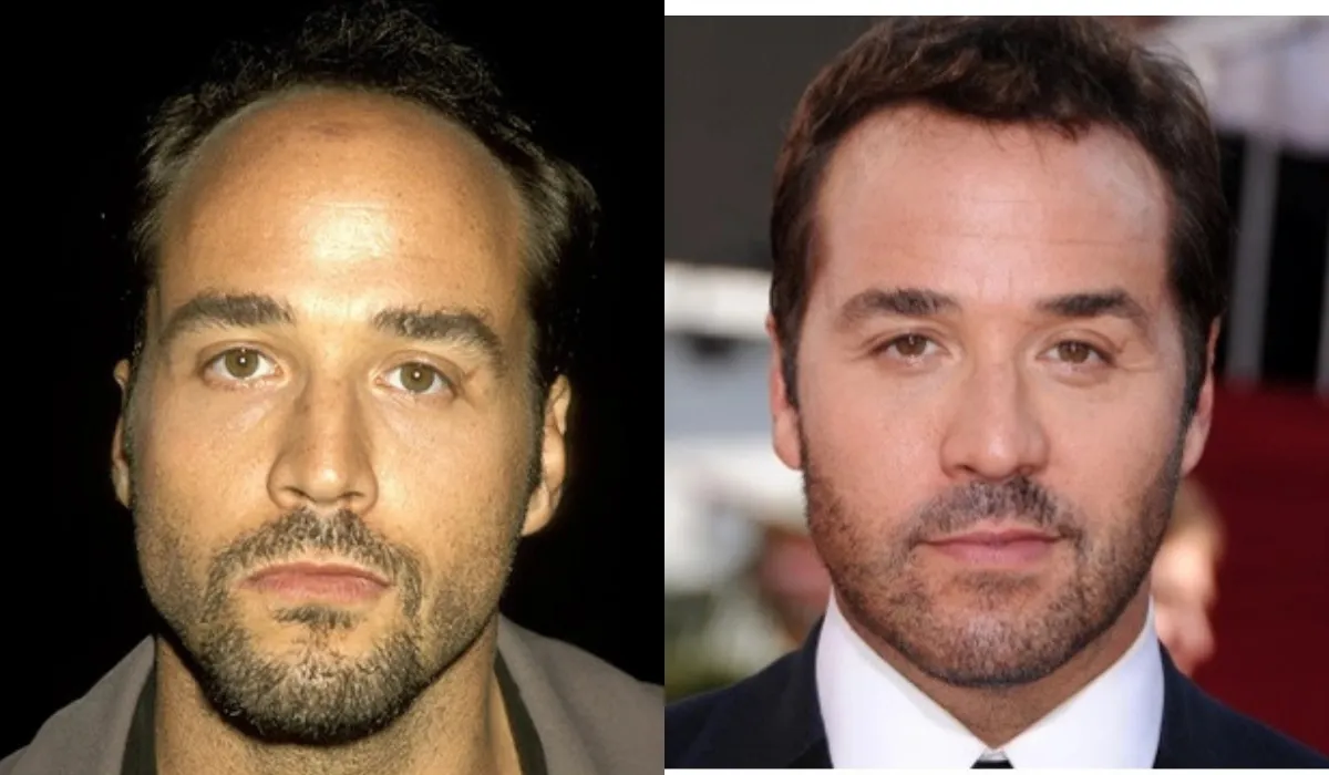 Jeremy Piven Hair Transplant