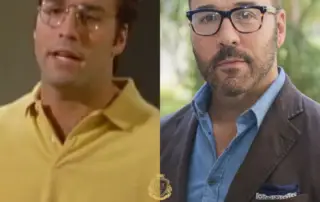 Jeremy Piven Hair Transplant