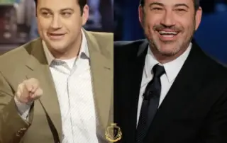 Jimmy Kimmel Hair Transplant