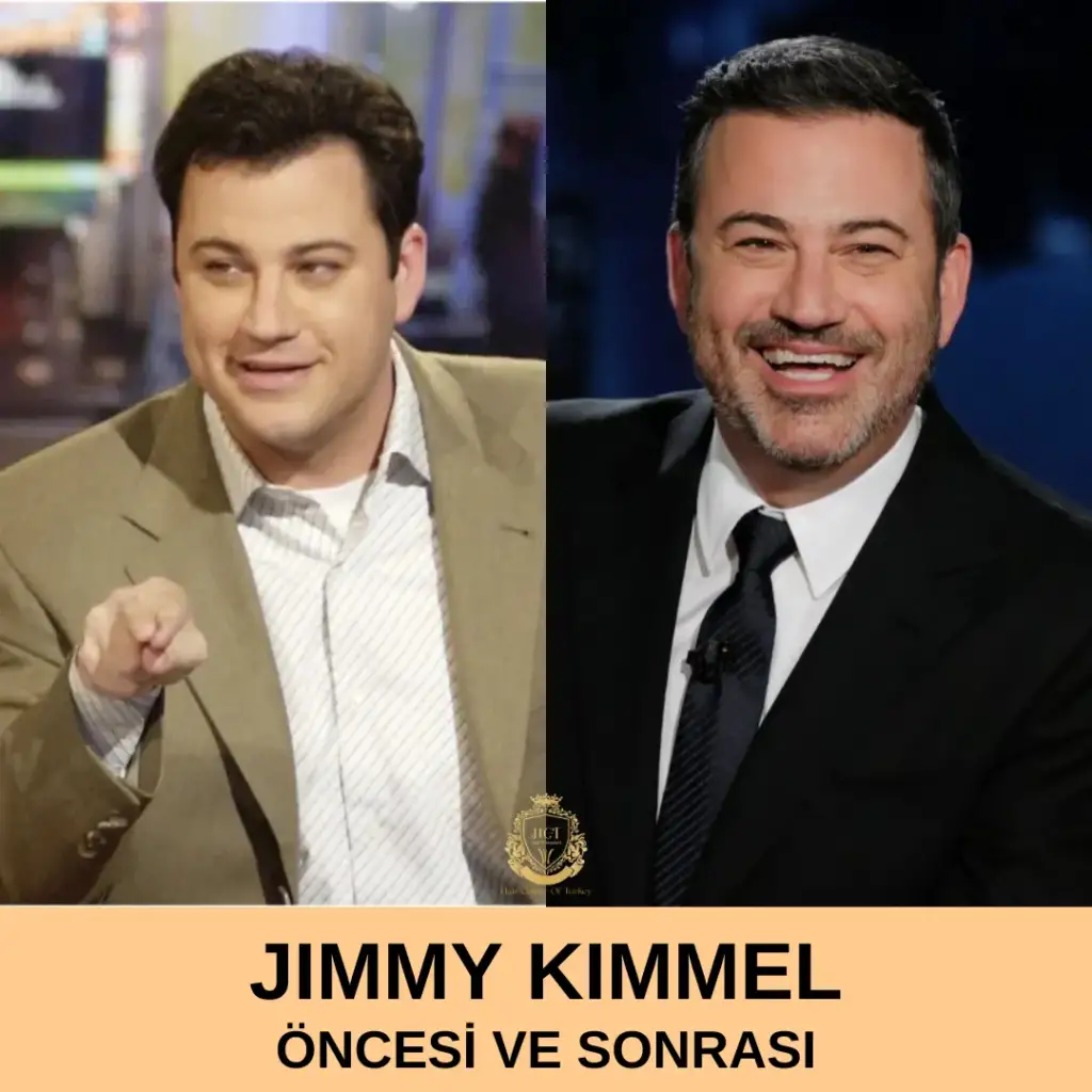 Jimmy Kimmel Saç Ekimi