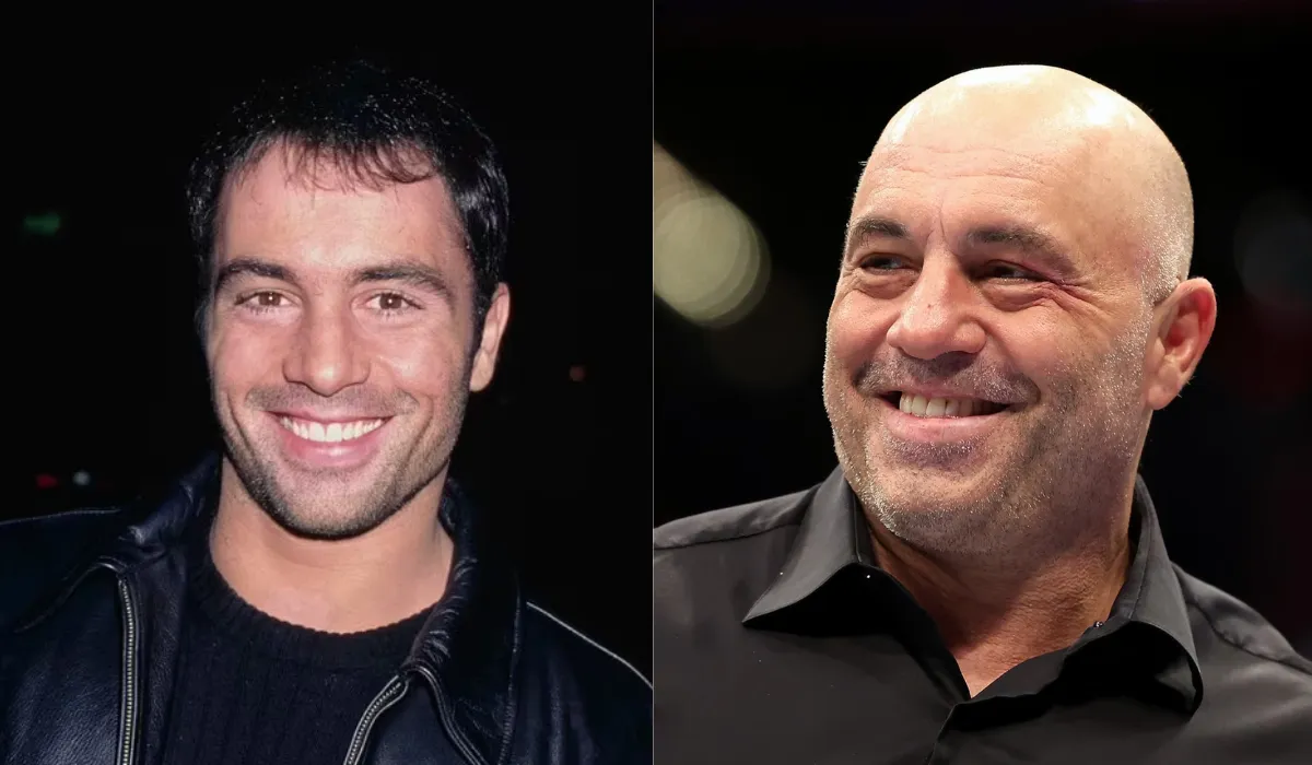 Joe Rogan Hair Transplant