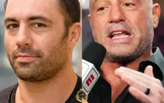 Joe Rogan Hair Transplant Before and After