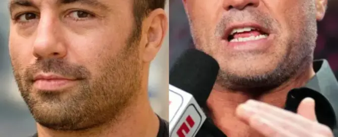 Joe Rogan Hair Transplant Before and After