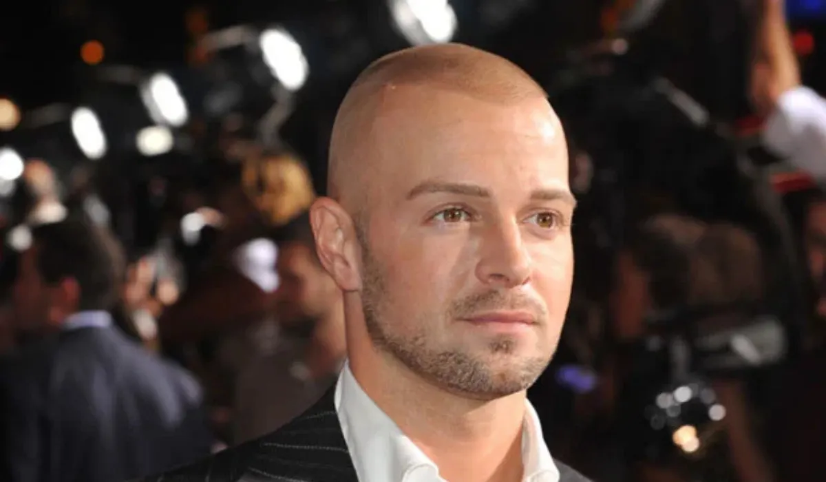 Joey Lawrence Hair Transplant 