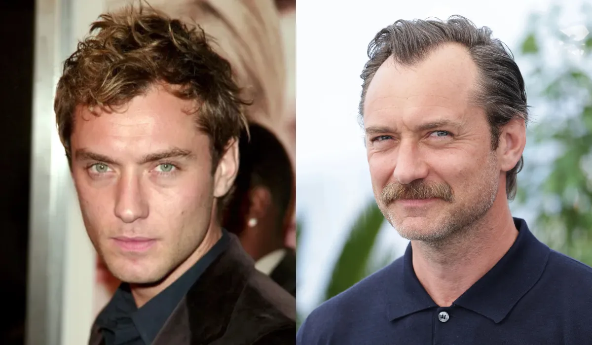 Jude Law Hair Transplant