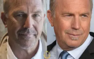 Kevin Costner Hair Transplant Before and After