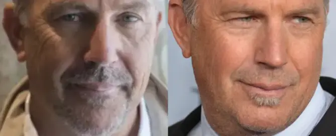 Kevin Costner Hair Transplant Before and After