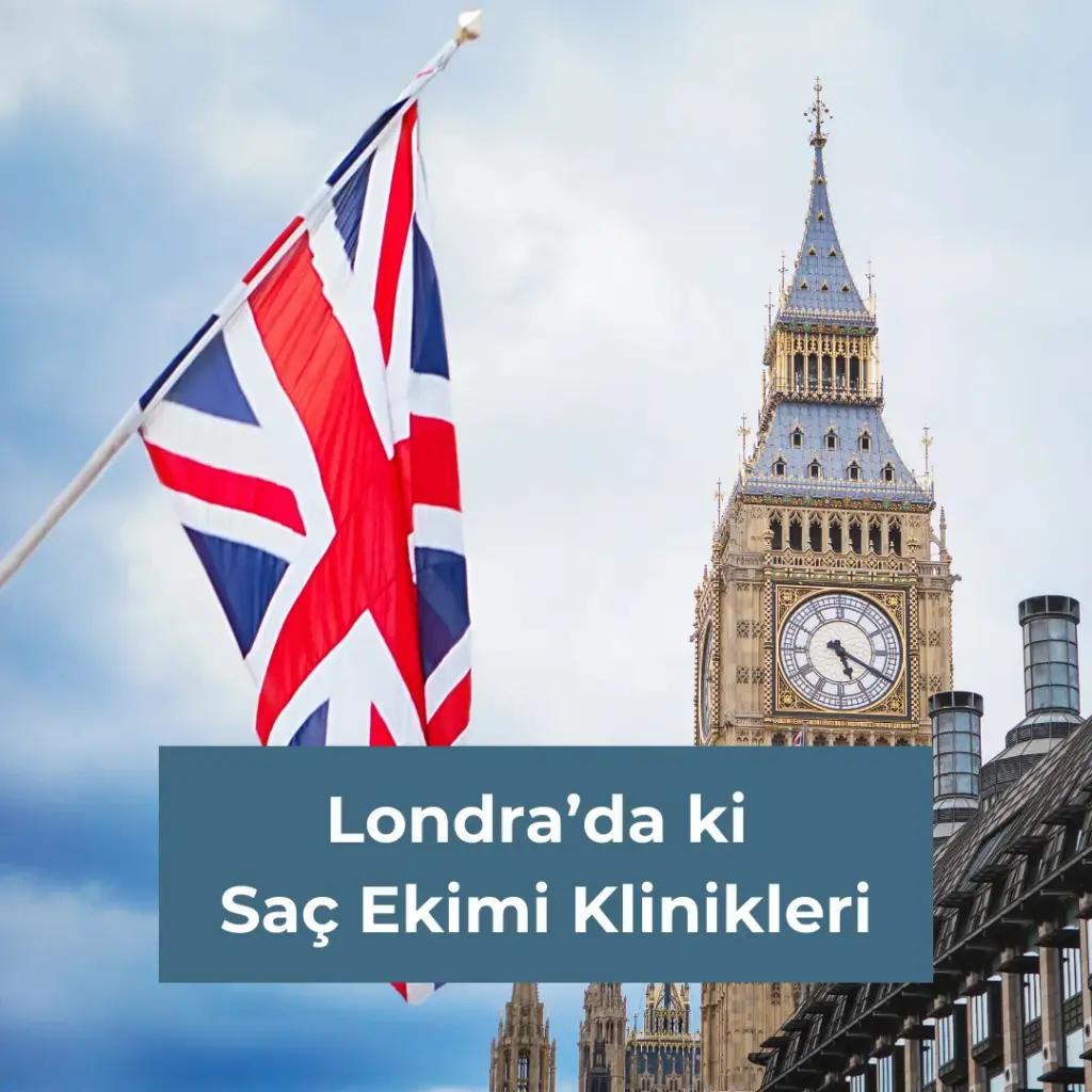 Londra’da ki Saç Ekimi Klinikleri