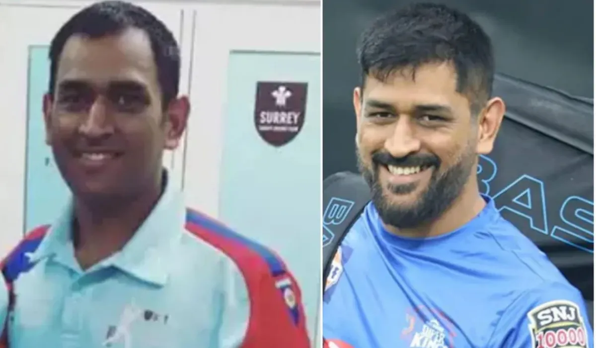 MS Dhoni Hair Transplant