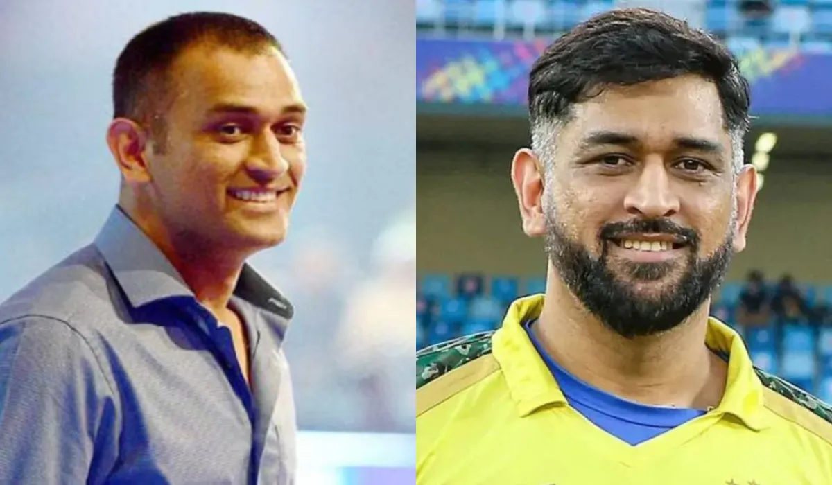 MS Dhoni Hair Transplant