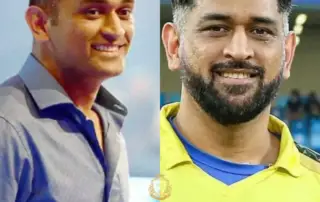 MS Dhoni Hair Transplant