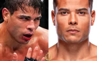 Paulo Costa Hair Transplant Before and After