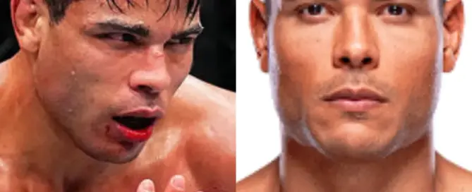 Paulo Costa Hair Transplant Before and After