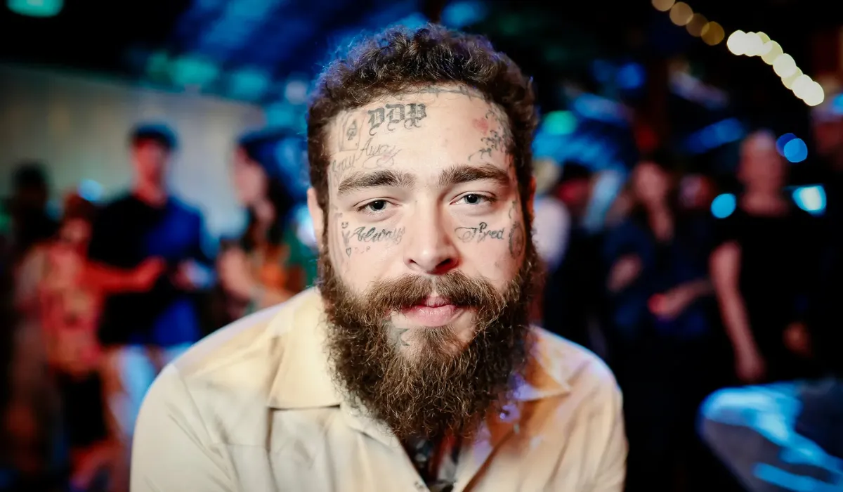 Post Malone Hair Transplant