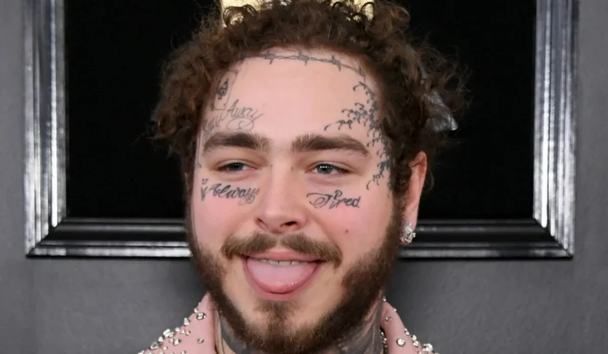 Post Malone Hair Transplant