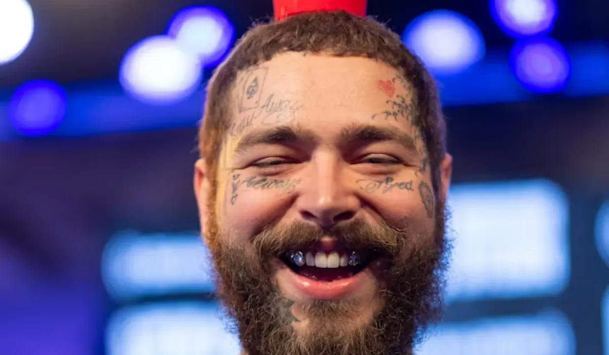 Post Malone Hair Transplant