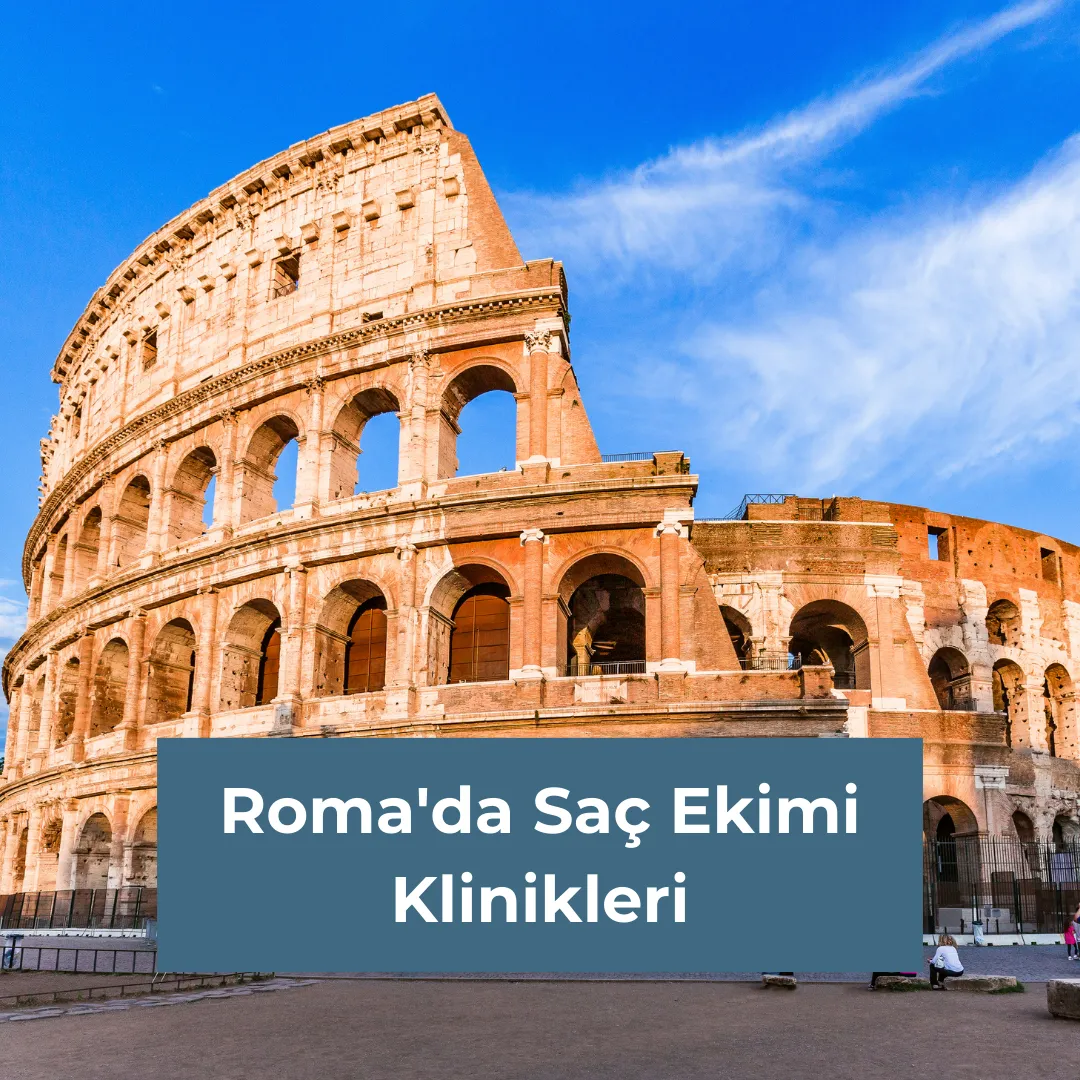 Roma'da Saç Ekimi Klinikleri