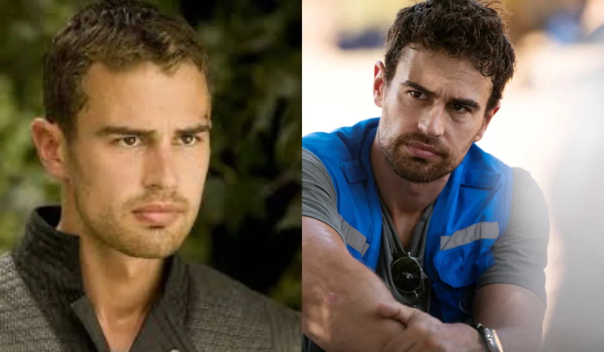 Theo James Hair Transplant