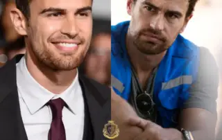 Theo James Hair Transplant