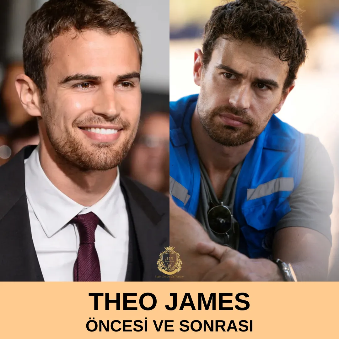 Theo James Saç Ekimi