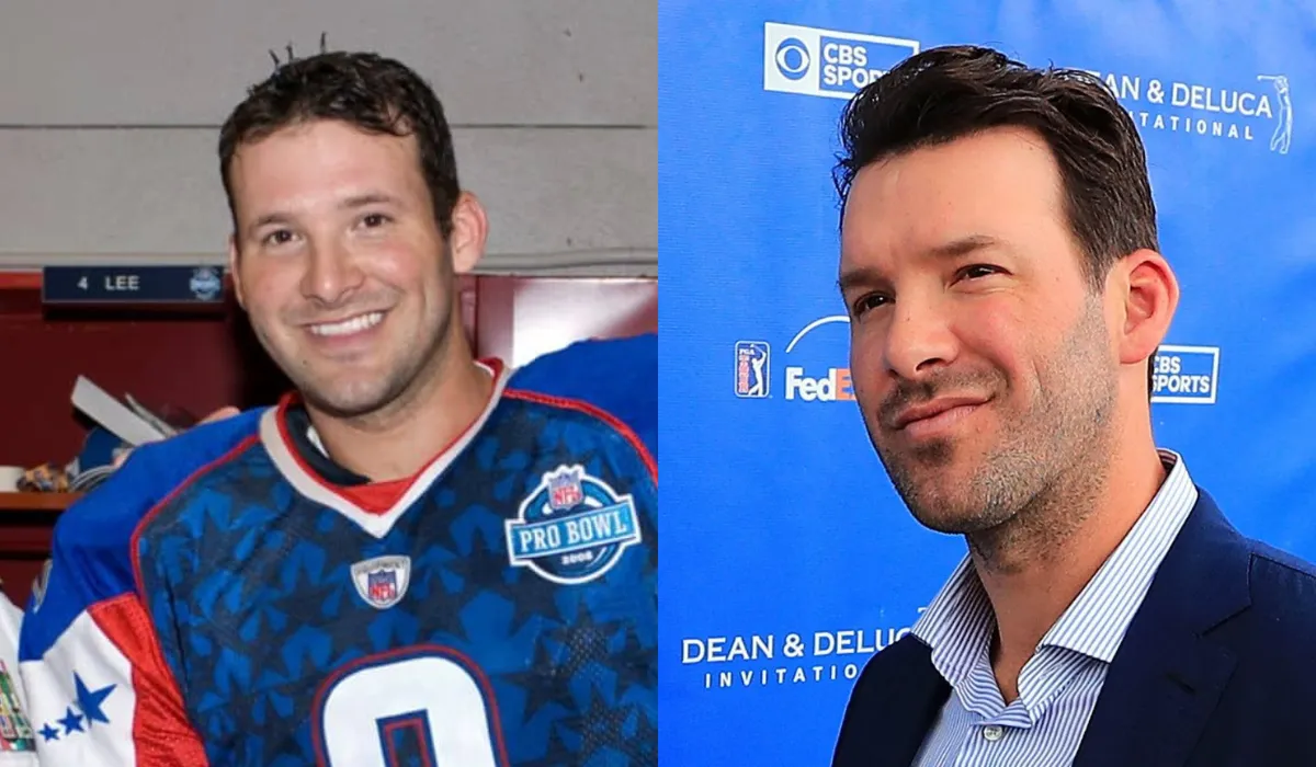 Tony Romo Hair Transplant