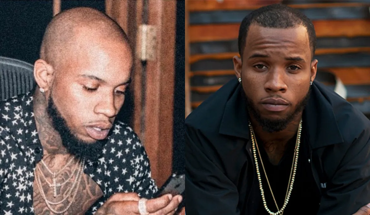 Tory Lanez Hair Transplant