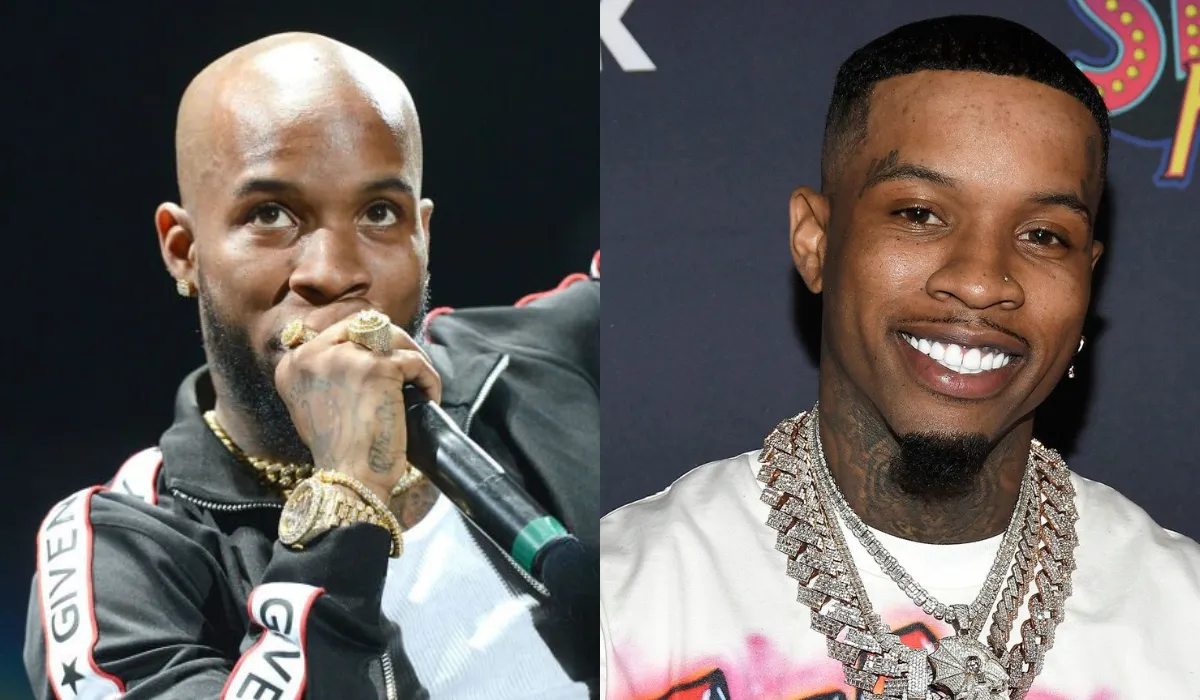 Tory Lanez Hair Transplant