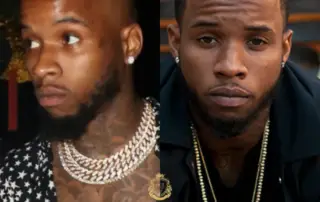 Tory Lanez Hair Transplant