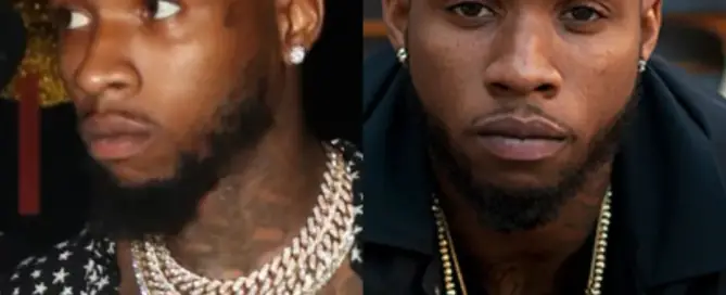 Tory Lanez Hair Transplant