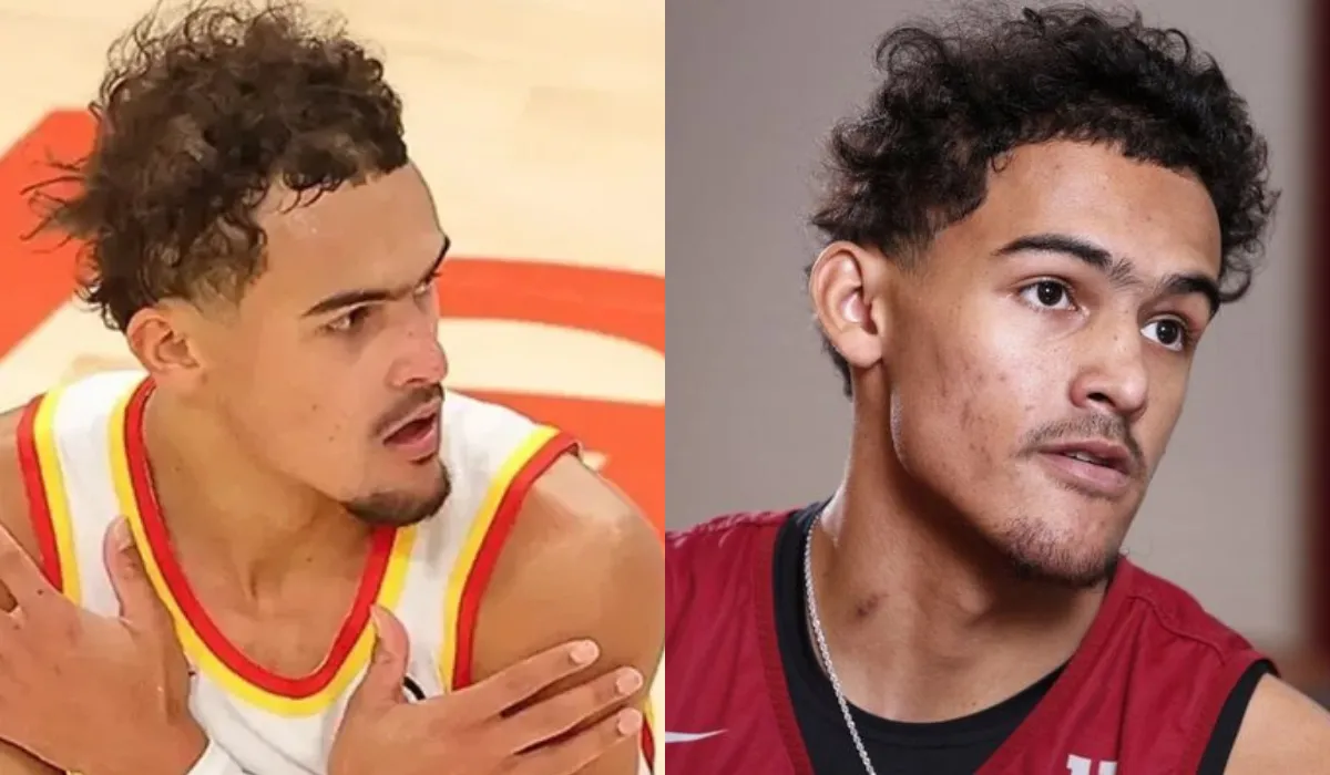 Trae Young Hair Transplant 