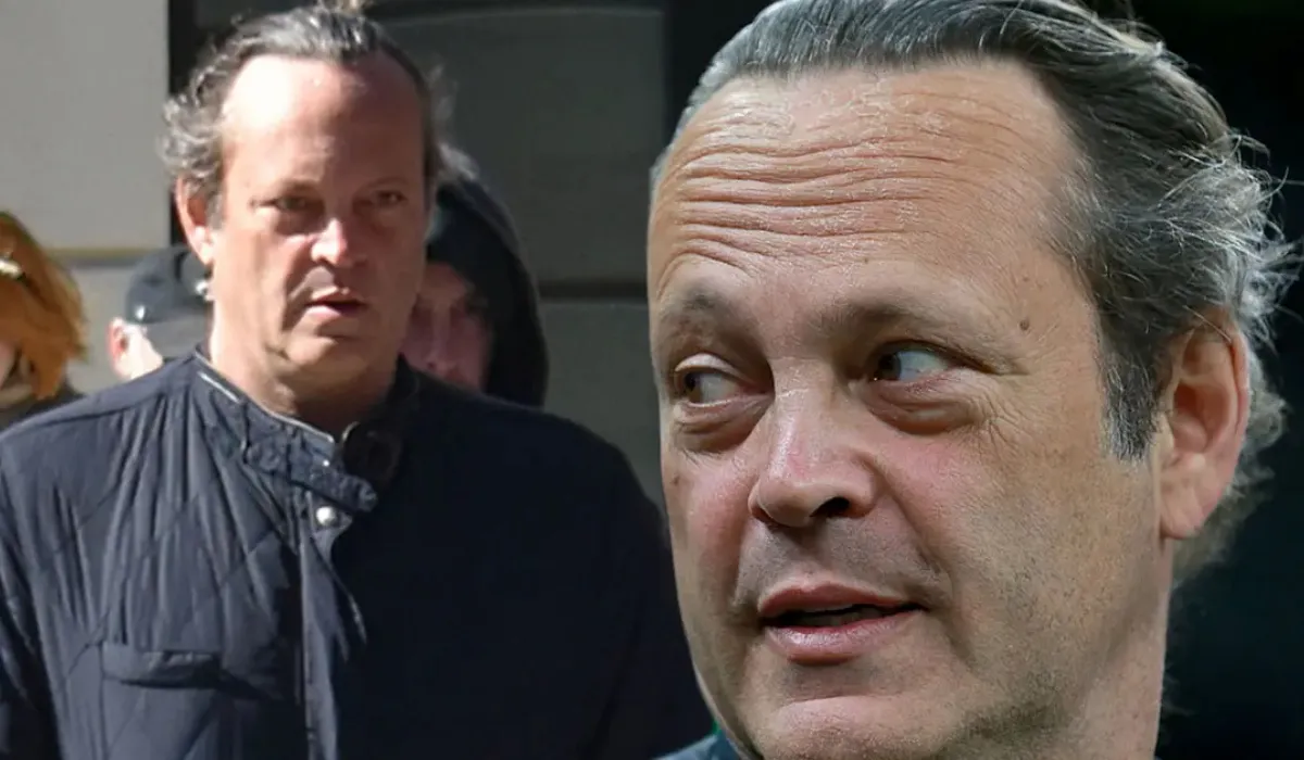 Vince Vaughn Hair Transplant