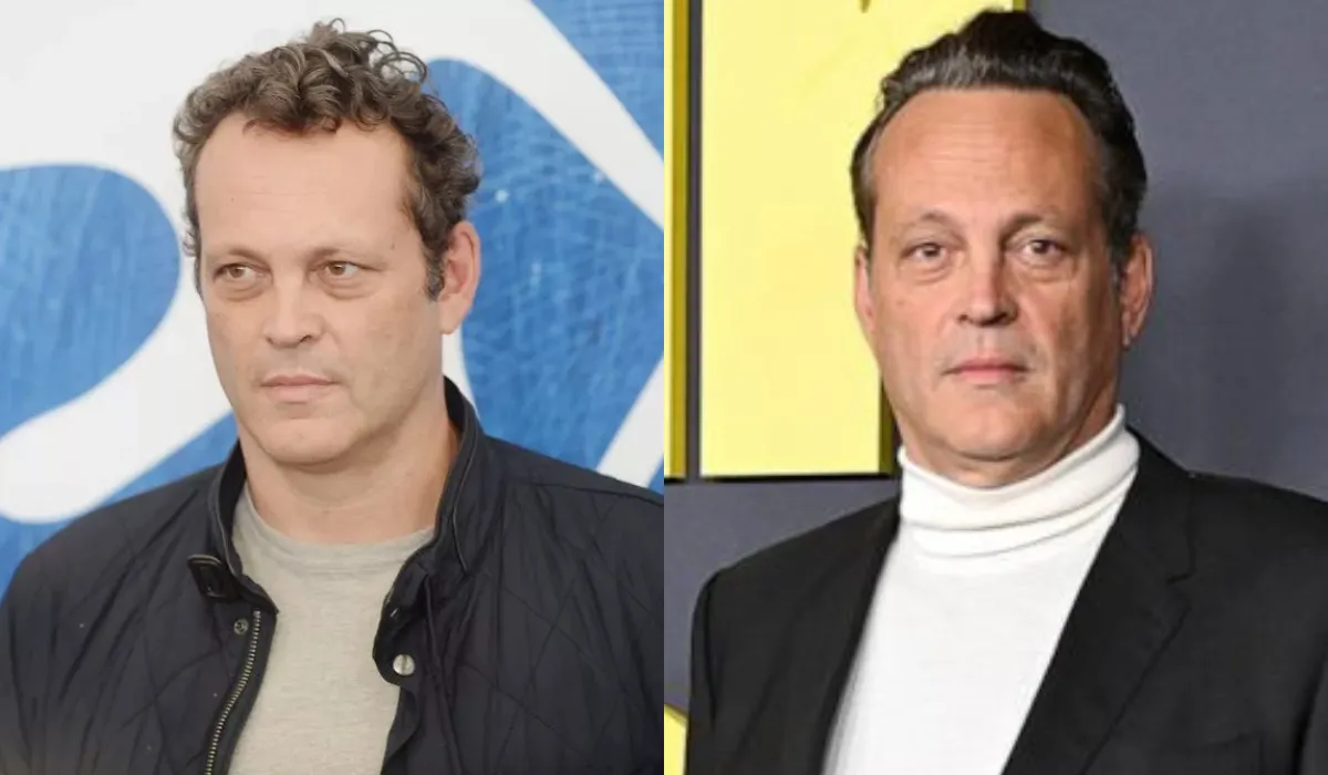 Vince Vaughn Hair Transplant