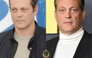 Vince Vaughn Hair Transplant