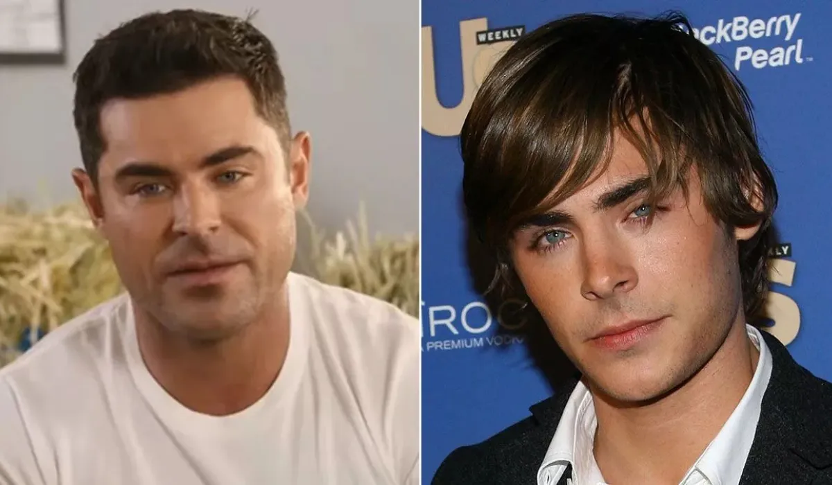 Zac Efron Hair Transplant