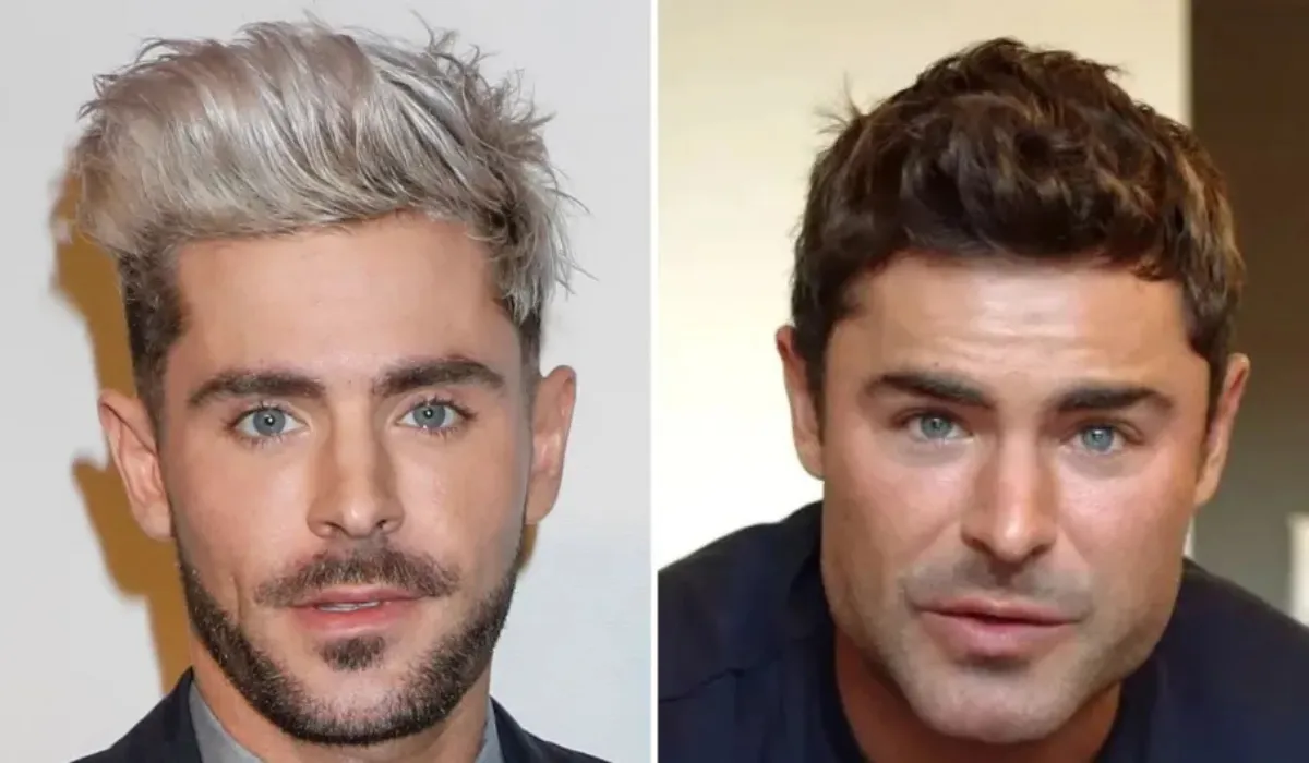 Zac Efron Hair Transplant